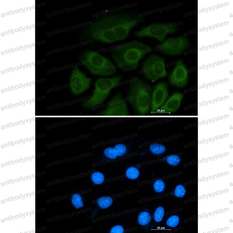 Anti-ACLY Antibody (R1Y74)