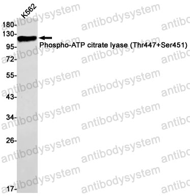 Anti-Phospho-ACLY (Thr447/Ser451) Antibody (R1Y73)