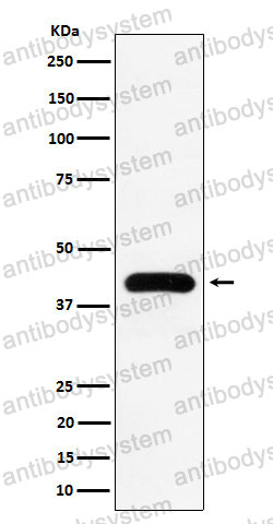 Anti-MVD Antibody (R1Y75)