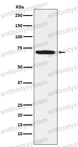 Anti-LIMK1 Antibody (R1Y77)