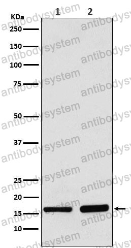 Anti-AP2S1 Antibody (R1Y79)