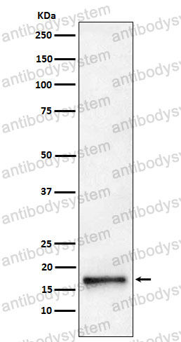 Anti-AP2S1 Antibody (R1Y78)