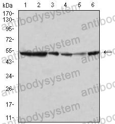 Anti-MAPK10/JNK3 Antibody (R3N06)