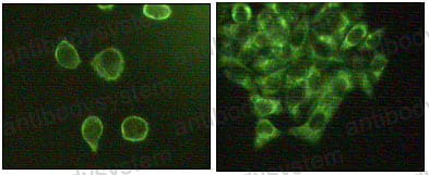 Anti-MAPK10/JNK3 Antibody (R3N05)