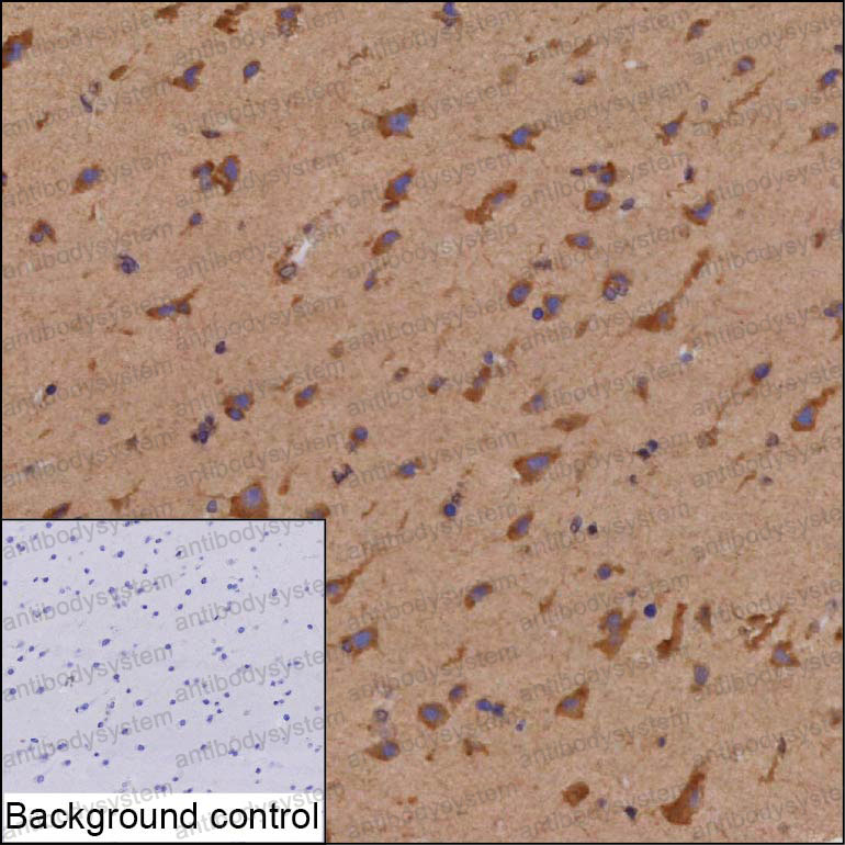 Anti-TTC3 Antibody (R3N07)