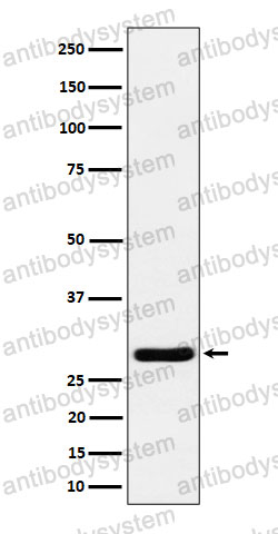 Anti-RCAN1 Antibody (R1Y80)
