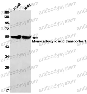 Anti-SLC16A1/MCT1 Antibody (R1Y82)