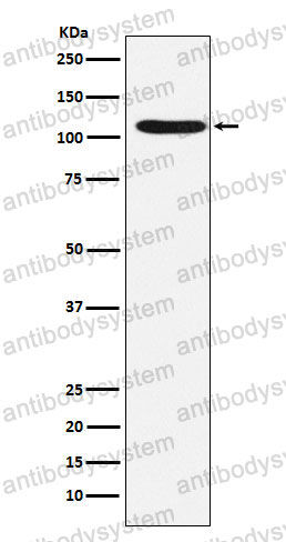Anti-HIRA Antibody (R1Y85)