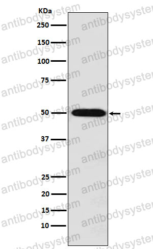 Anti-SLC16A1/MCT1 Antibody (R1Y81)
