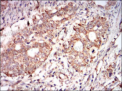 Anti-PRKAG1 Antibody (R3N17)