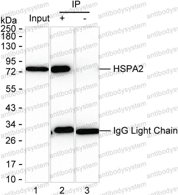 Anti-HSPA2 Antibody (R3N21)