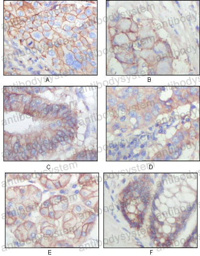 Anti-EPHB3 Antibody (R3N26)