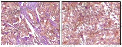 Anti-EPHB4 Antibody (R3N27)