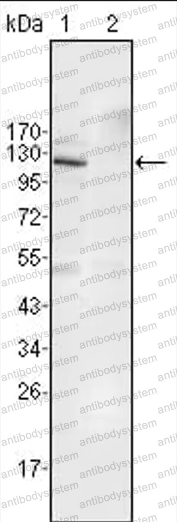 Anti-EPHB4 Antibody (R3N28)