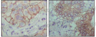 Anti-EPHB1 Antibody (R3N30)