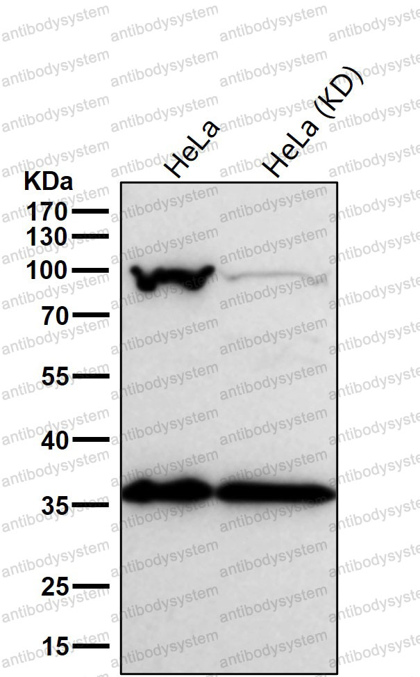 Western blot for Anti-CSE1L Antibody (R1Z11) ?>