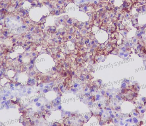 Anti-AQP5 Antibody (R1Z13)