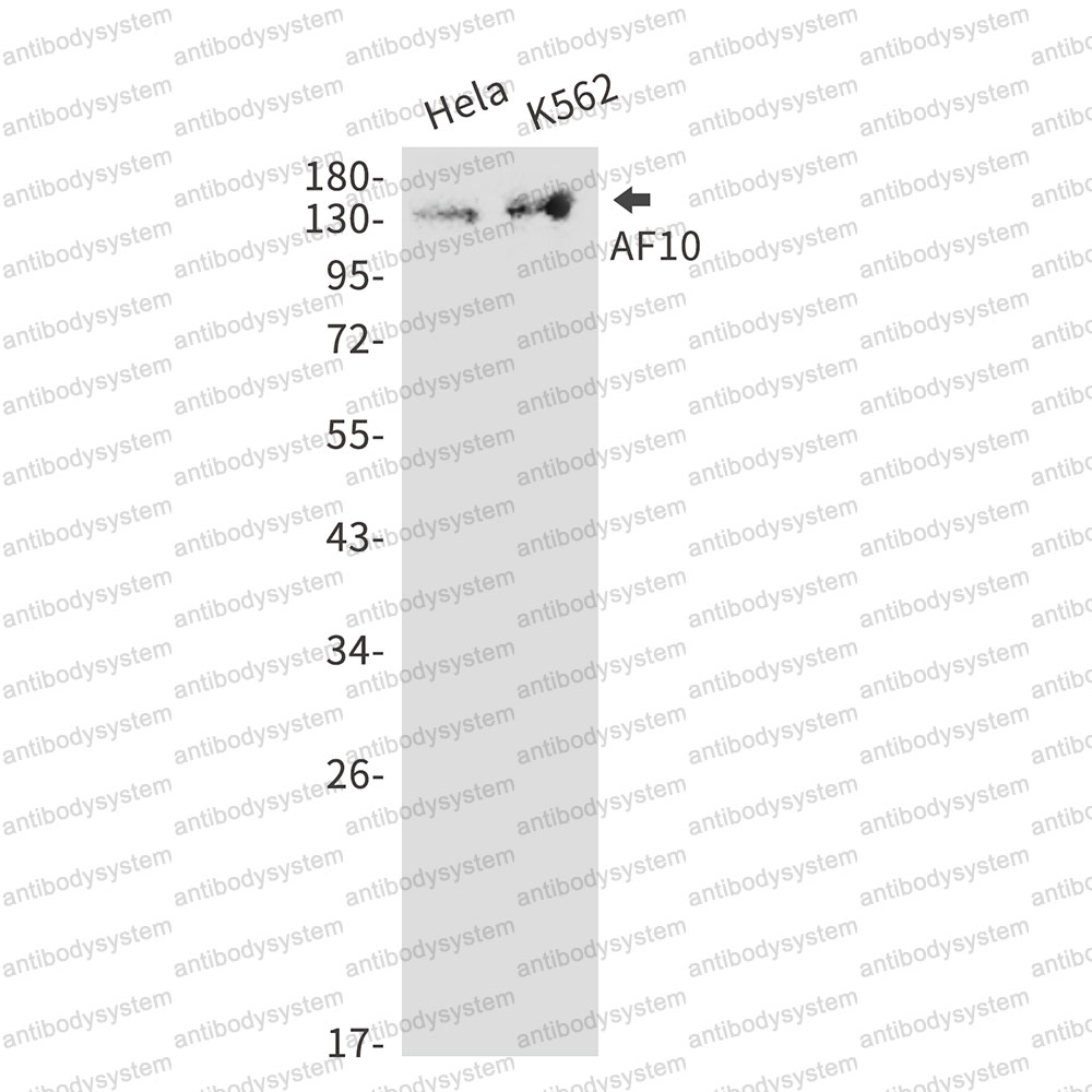 Anti-MLLT10 Antibody (R1Z18)