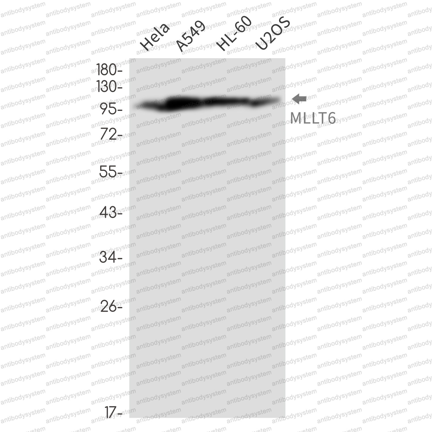 Anti-MLLT6 Antibody (R1Z19)