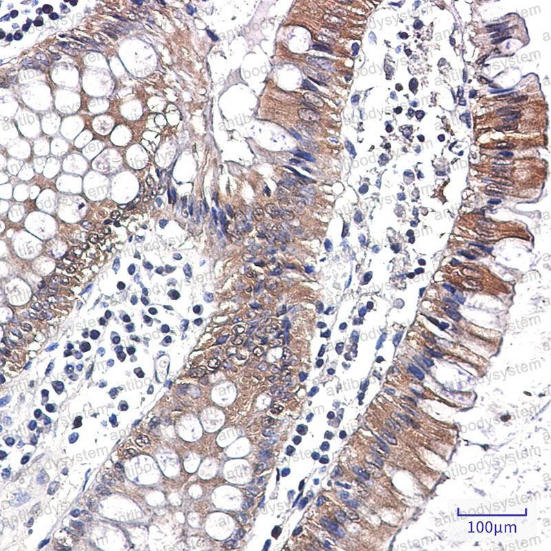Anti-CASP7 Antibody (R1Z23)