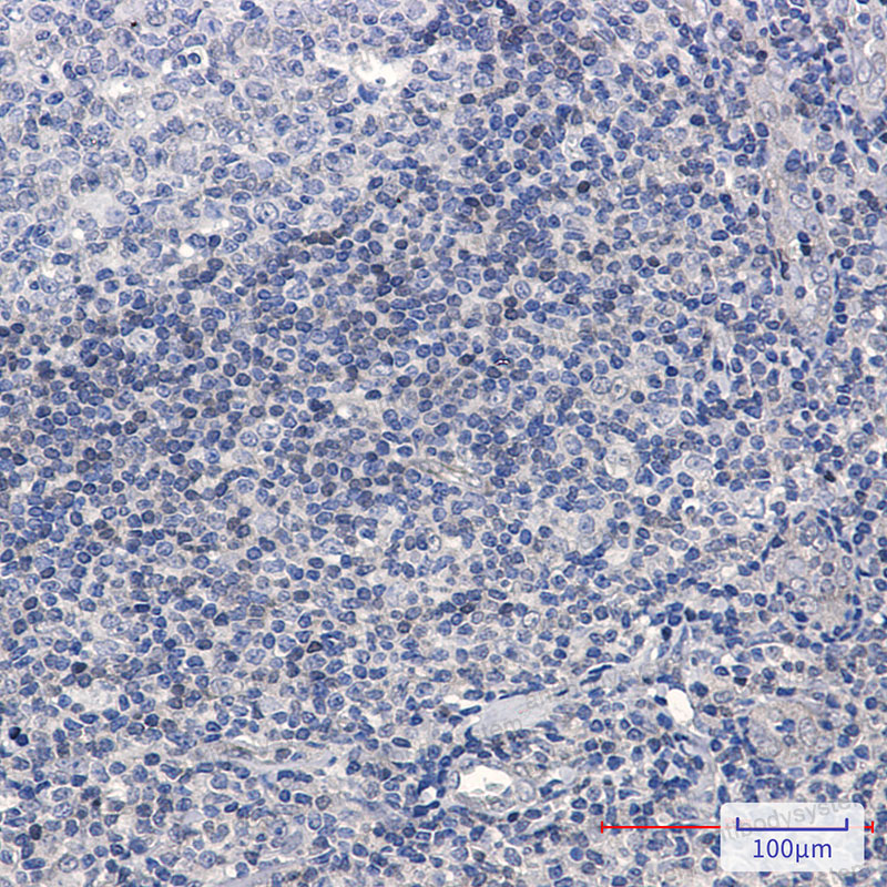 Anti-ADK Antibody (R1Z30)