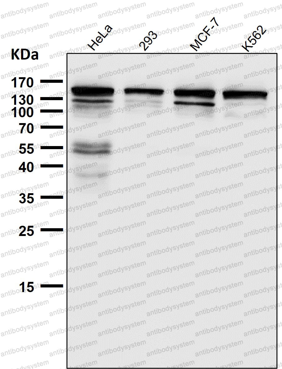 Anti-ADAR/IFI4 Antibody (R1Z31)