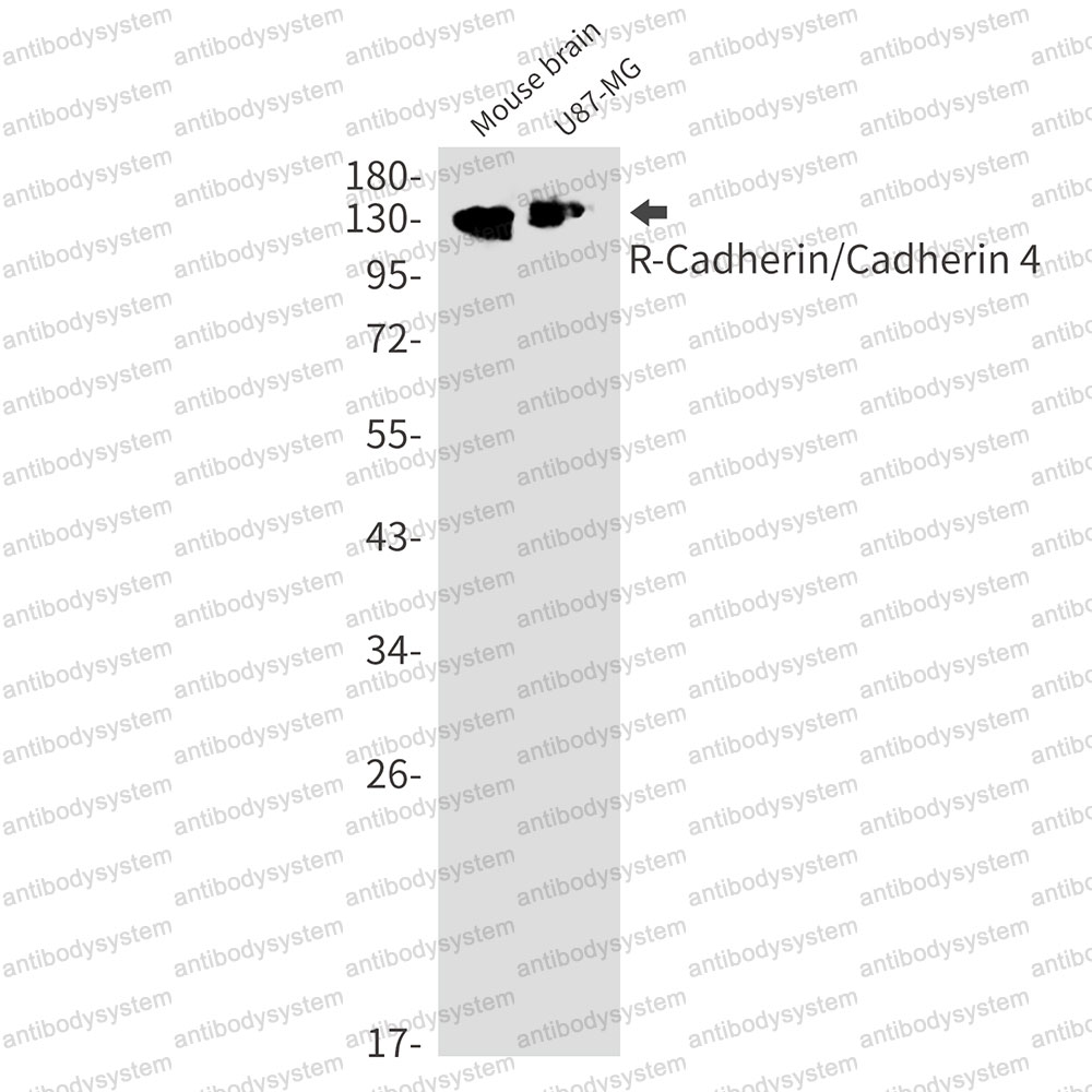 Anti-CDH4 Antibody (R1Z33)