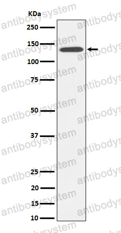 Anti-CDH4 Antibody (R1Z32)