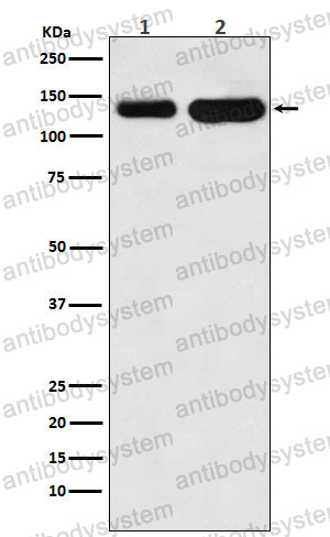 Anti-CDH6/Cadherin-6 Antibody (R1Z34)