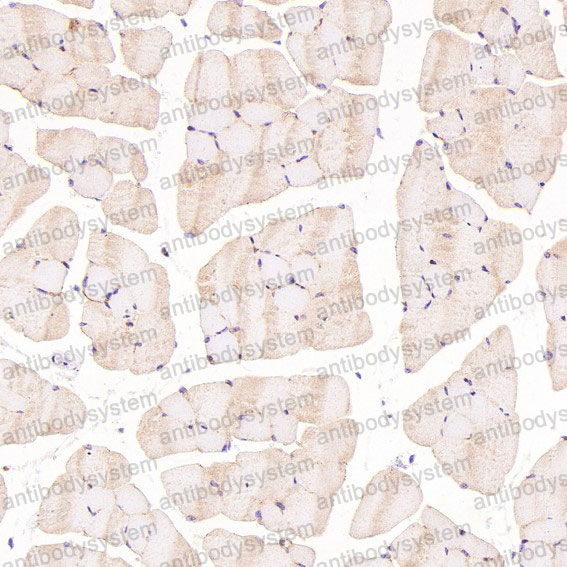 Anti-CDH13 Antibody (R1Z35)