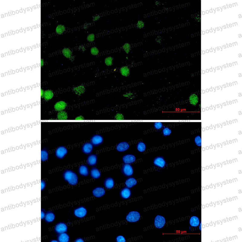 Anti-FOXA1 Antibody (R1Z37)