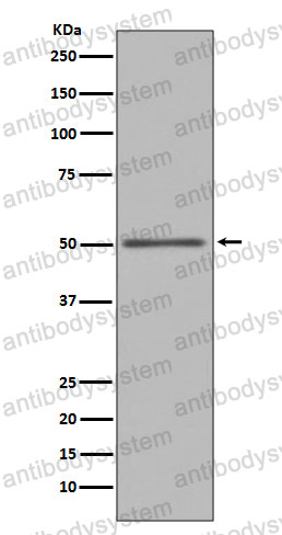 Anti-FOXA1 Antibody (R1Z36)