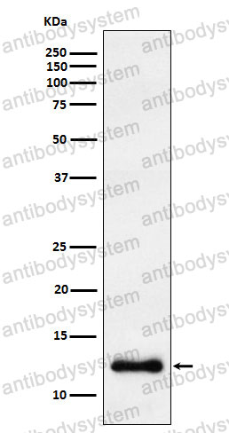 Anti-CCL23/MIP-3/MPIF-1 Antibody (R1Z39)