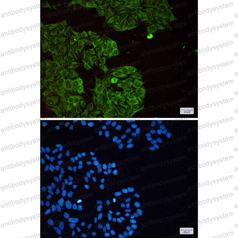 Anti-EIF3B Antibody (R1Z43)