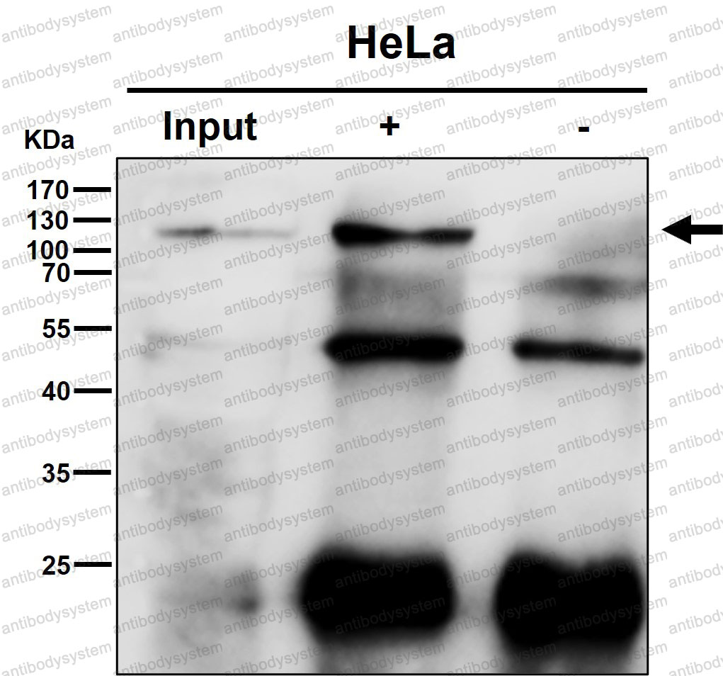 Anti-EIF3B Antibody (R1Z41)