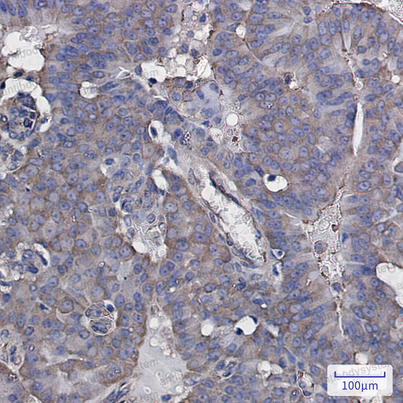 Anti-EIF3B Antibody (R1Z42)