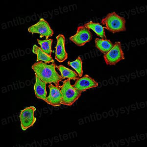 Anti-UCP3 Antibody (R3N49)