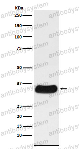 Anti-LGALS4 Antibody (R1Z47)