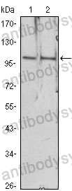 Anti-HDAC4 Antibody (R3N54)