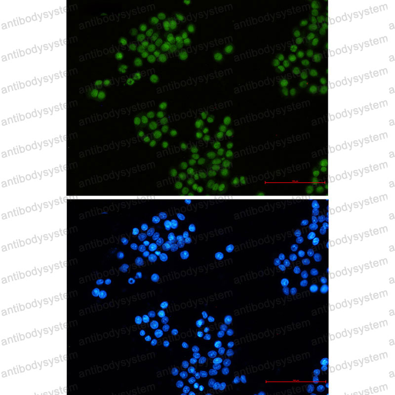 Anti-CTBP2 Antibody (R1Z50)