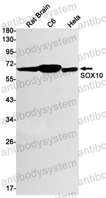 Anti-SOX10 Antibody (R1Z52)