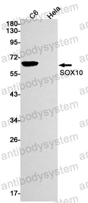 Anti-SOX10 Antibody (R1Z51)