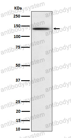 Anti-Phospho-BCAR1 (Y410) Antibody (R1Z56)