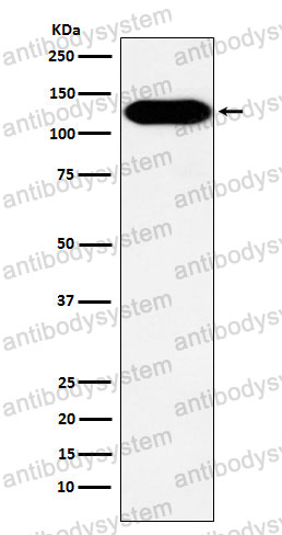 Anti-BCAR1 Antibody (R1Z55)