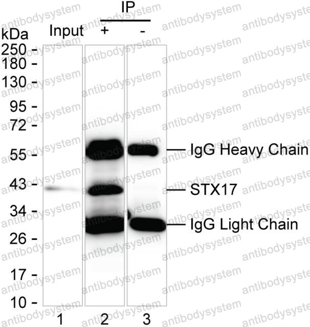 Anti-STX17 Antibody (R3N64)