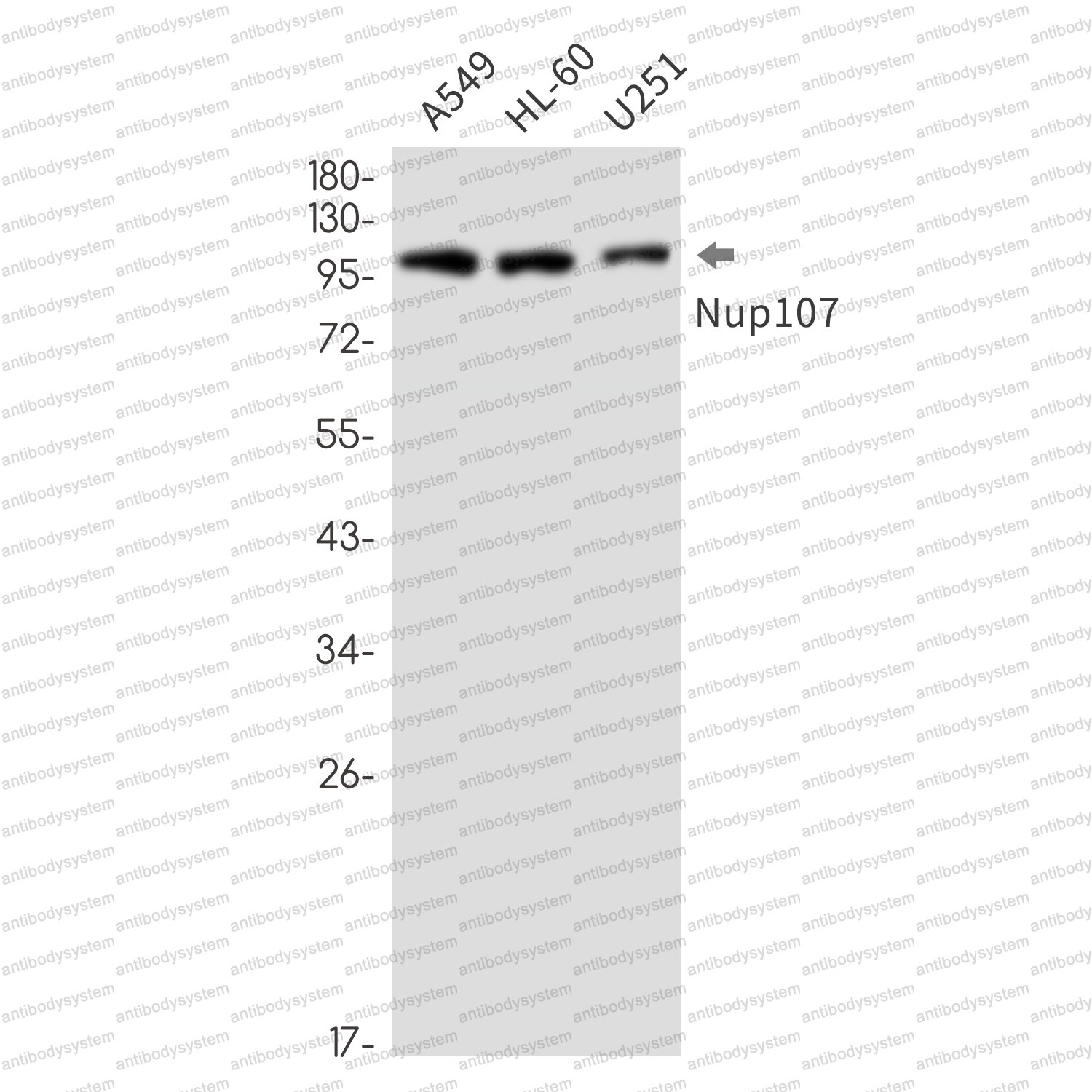 Anti-NUP107 Antibody (R1Z62)