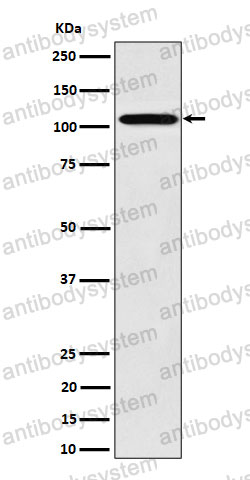 Anti-NUP107 Antibody (R1Z60)