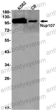 Anti-NUP107 Antibody (R1Z61)