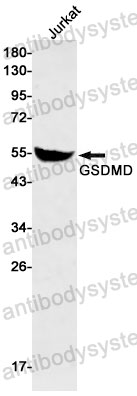 Anti-GSDMD/Gasdermin-D Antibody (R1Z63)