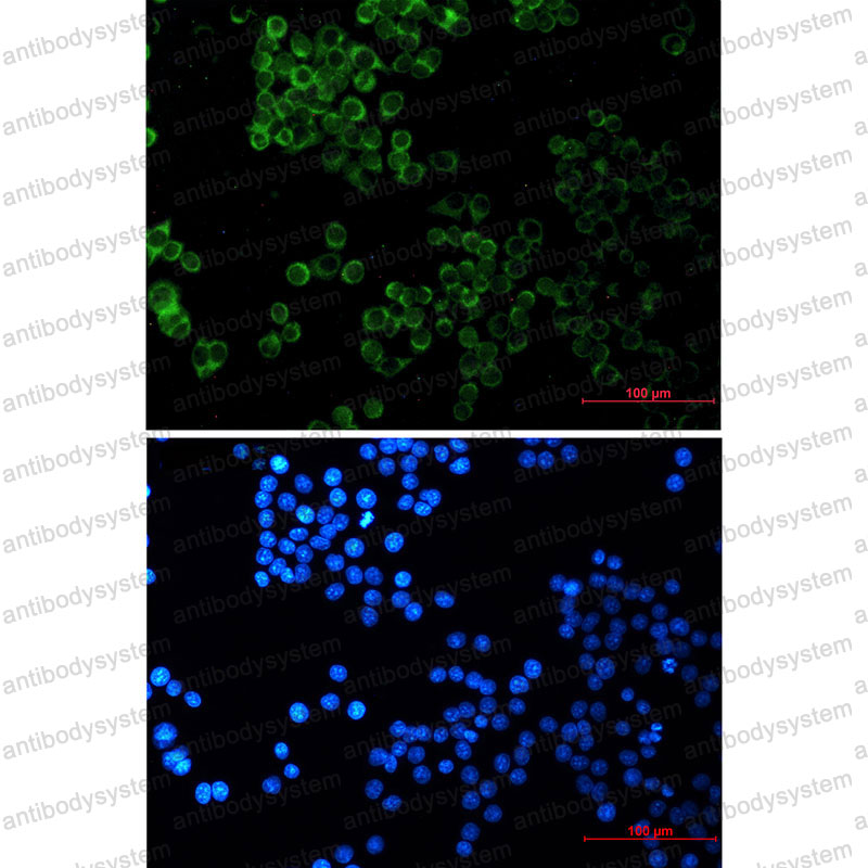 Anti-SESN2 Antibody (R1Z64)